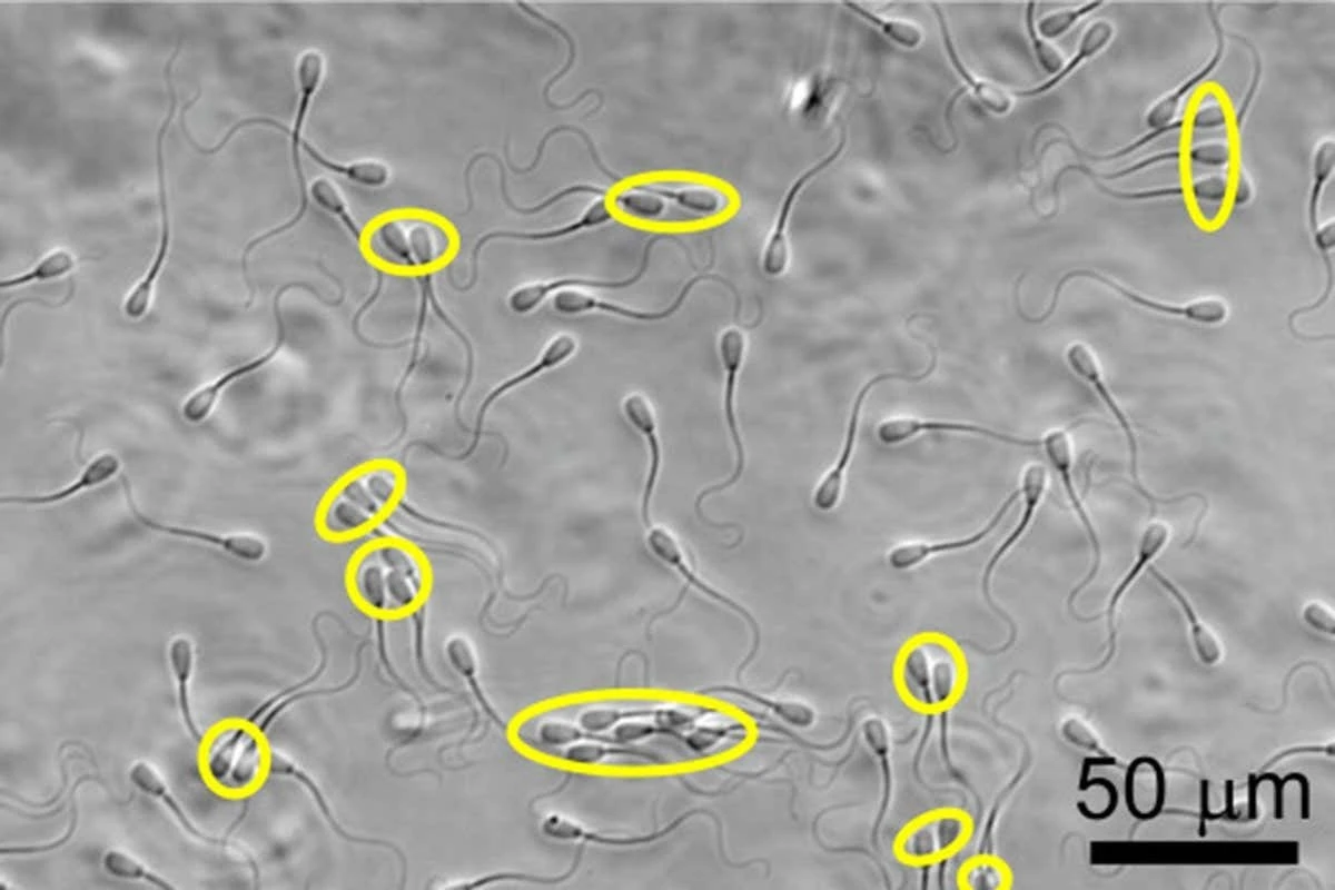 Plemniki ignorują prawo Newtona: Ta dziwna fala omija fizykę - image 1